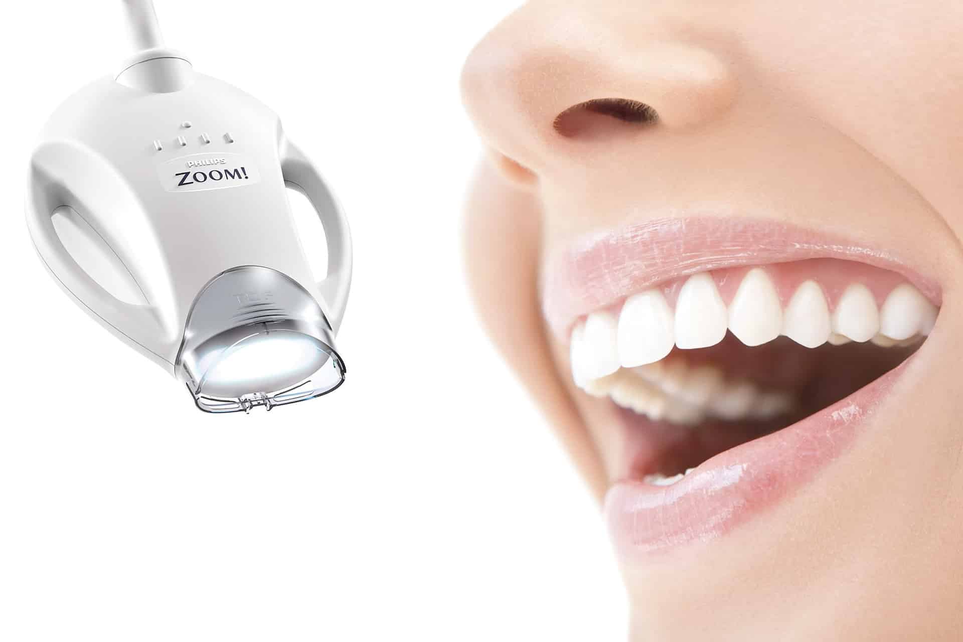 Teeth Whitening Gold Coast with Zoom Whitening